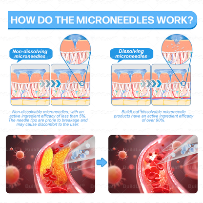 One last chance! Grab this lucky find at 70% OFF!🔥   𝐵uil𝗱𝐿ea𝐟®